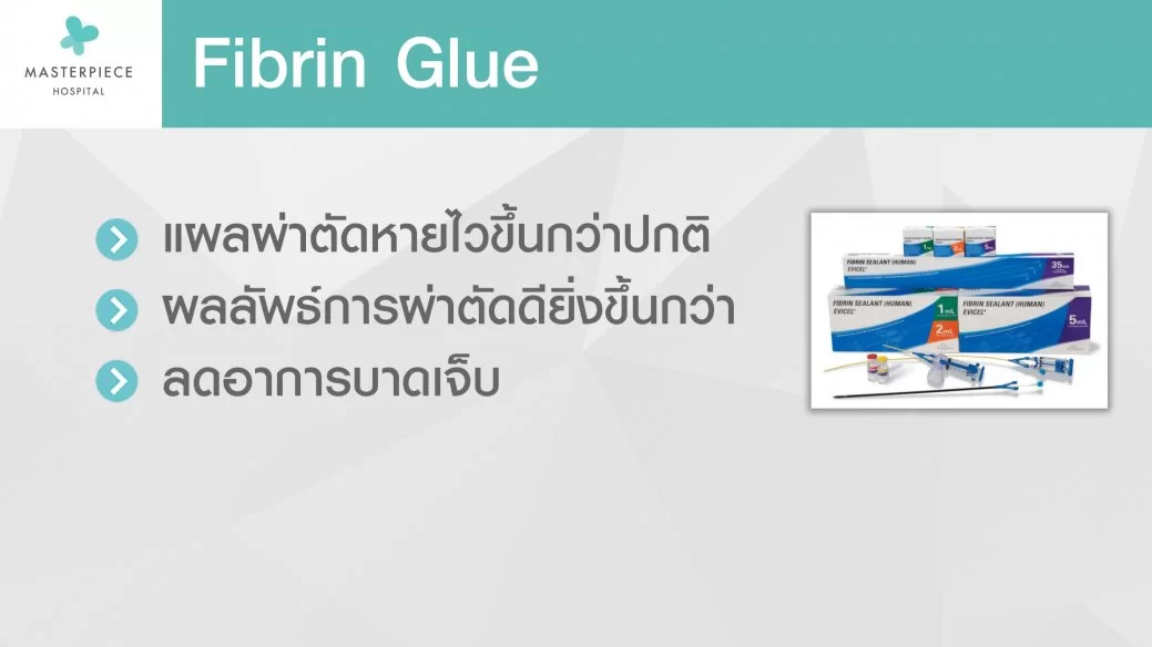 纤维蛋白胶 （Fibrin Glue）