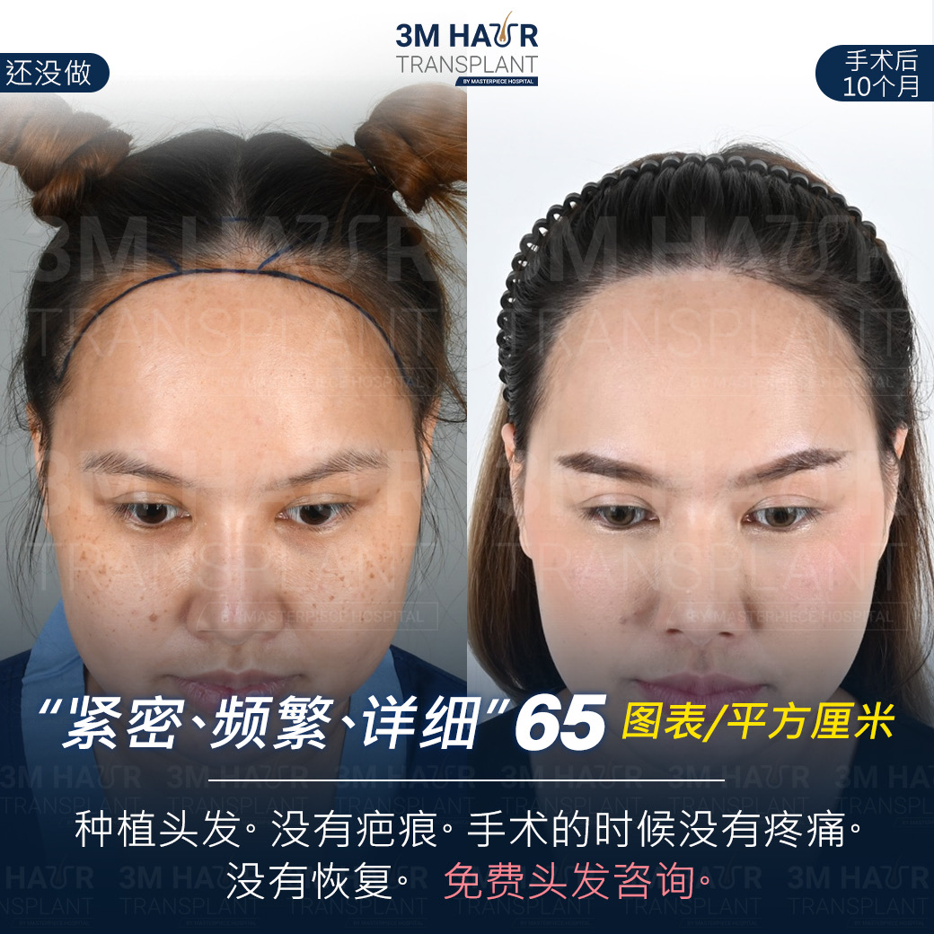 头发护理中心的案例