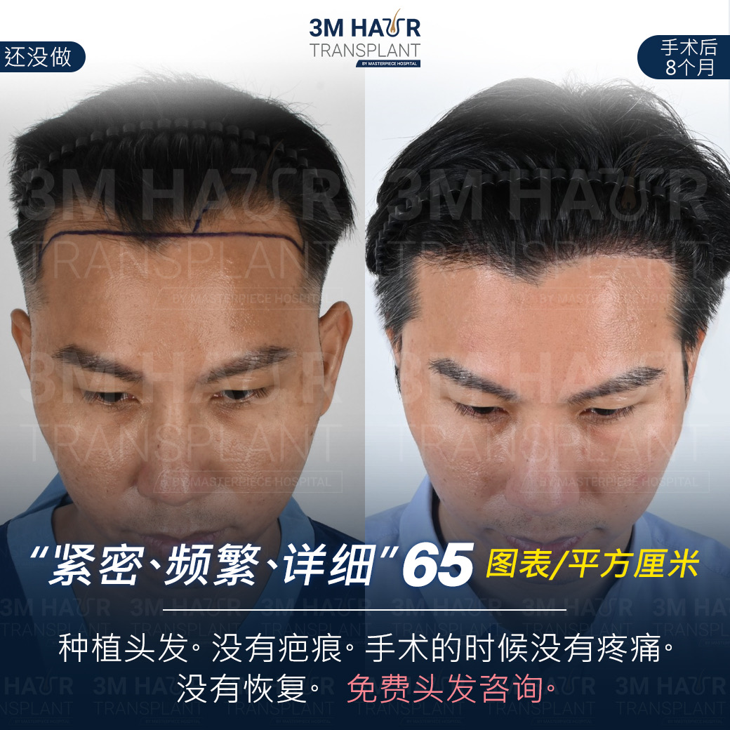 头发护理中心的案例